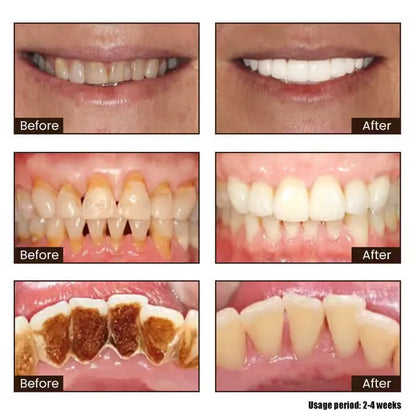 New 7-Pro Intensive Toothpaste | Upgraded Purple Formula with 7 Probiotics | Deep Enamel Repair & Long-Lasting Freshness#dealsforyoudays